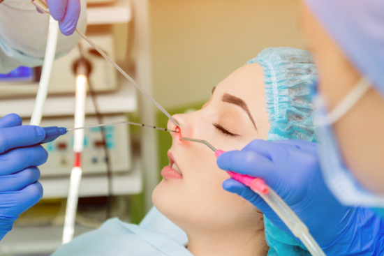 Cirugía endoscópica nasal (senos paranasales/nariz)